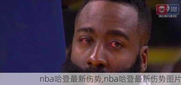 nba哈登最新伤势,nba哈登最新伤势图片